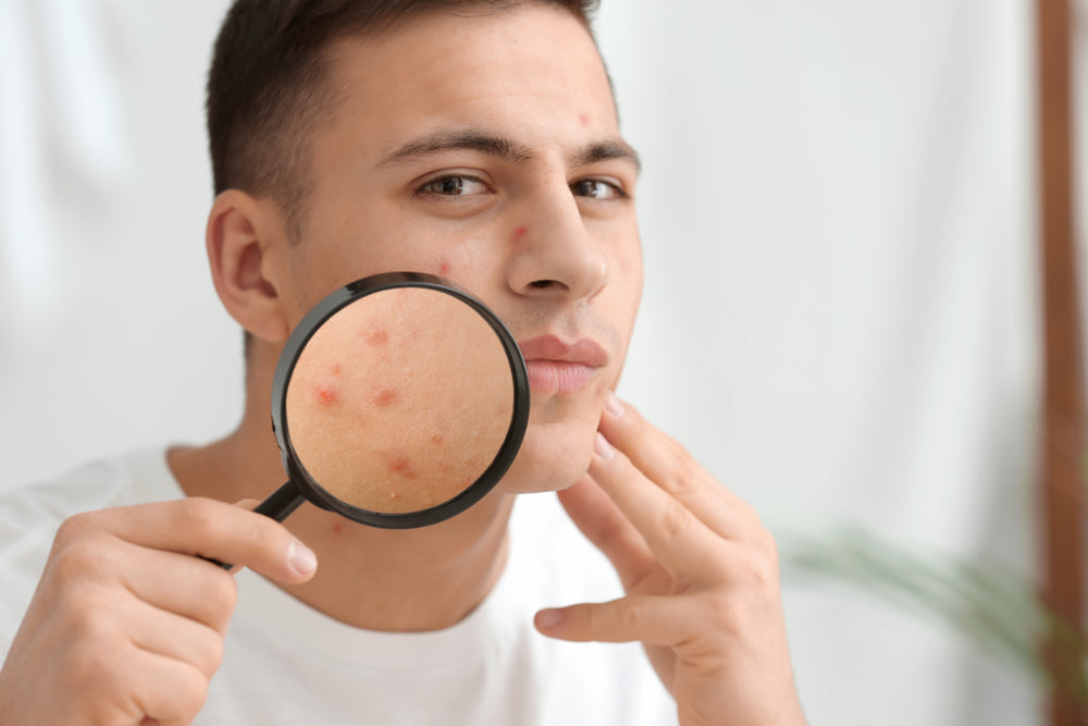 sleep products for people with acne and sensitive skin